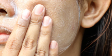 Технология и как проводится пилинг лица