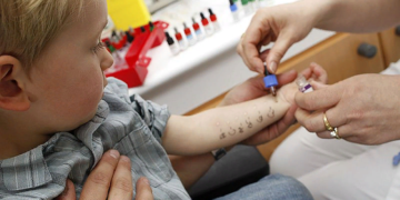 Анализы на аллергены: правила и требования к сдаче