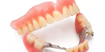 Основные разновидности зубных протезов и их выбор
