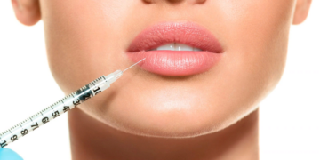 Какие выбрать филлеры для губ и их основное назначение