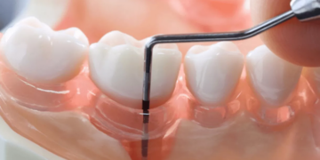 Что нужно знать про лечение десен и несколько советов